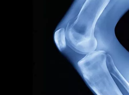 Исследование пористости костных и тканевых структур на основе данных микро-КТ/МРТ