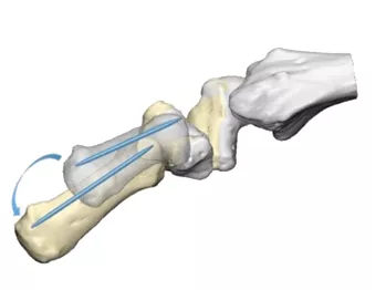 3D-реконструкция для изучения кинематики большого пальца