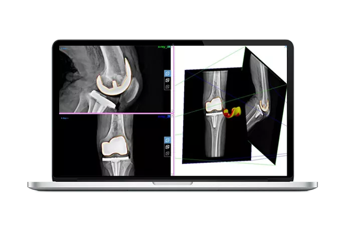 Программный продукт Materialise Mimics Innovation Suite (MIS) №1