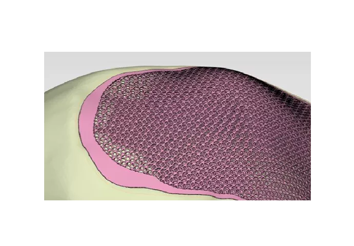 Программный продукт Materialise Mimics Innovation Suite (MIS)