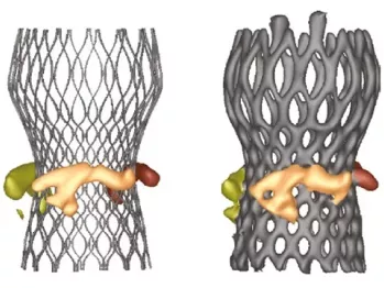 Оптимизация предоперационного планирования