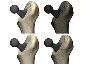 Оптимизация ортопедических исследований