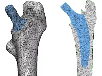 Конечно-элементное моделирование тазобедренного сустава