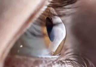 Как 3D‑моделирование помогает исследовать сетчатку  глаза в&nbsp;наномасштабе