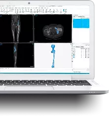 Materialise Mimics Innovation Suite