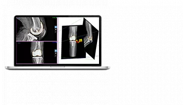 Программный продукт Materialise Mimics Innovation Suite (MIS)