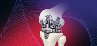 3D-технологии для производителей медицинского оборудования и&nbsp;изделий