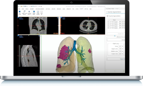 Pulmonology