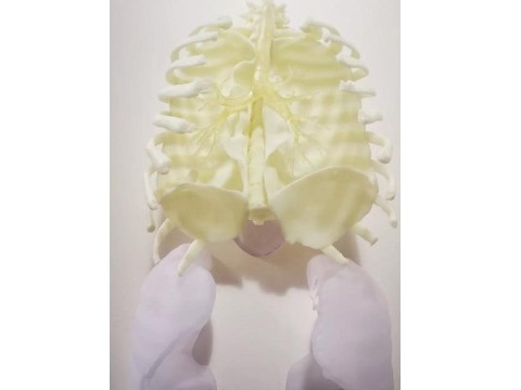Создание анатомической 3D‑модели органов пациента по технологии SLA