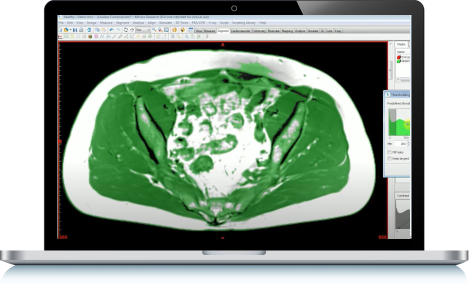 Muscle Segmentation