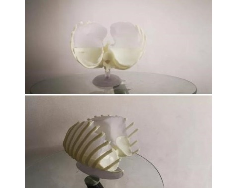 Создание анатомической 3D‑модели органов пациента по технологии SLA