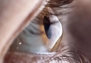 Как 3D‑моделирование помогает исследовать сетчатку  глаза в наномасштабе