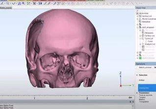 Имплантация и планирование операций: роль 3D‑моделирования в повышении качества лечения