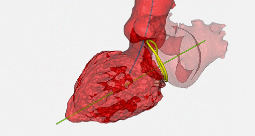 Создание 3D-моделей костей, мускулов, легких и сердечно-сосудистой системы из снимков МРТ и КТ